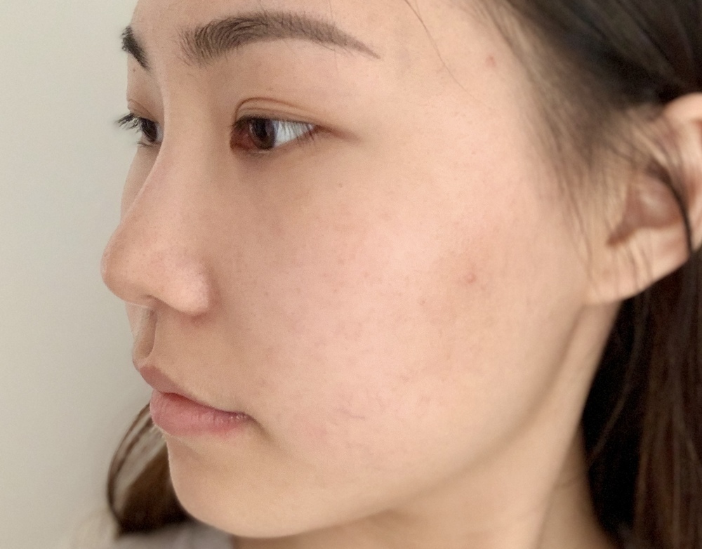 Kiehl's 全效再生超級精華 iTRIAL美評 super serum 實測 用後感 review